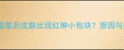 狗狗接种疫苗后皮肤出现红肿小包块原因与处理指南