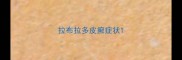 拉布拉多皮癣症状