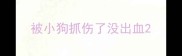 被小狗抓伤了没出血