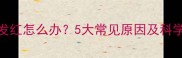猫咪鼻子发红怎么办5大常见原因及科学护理指南